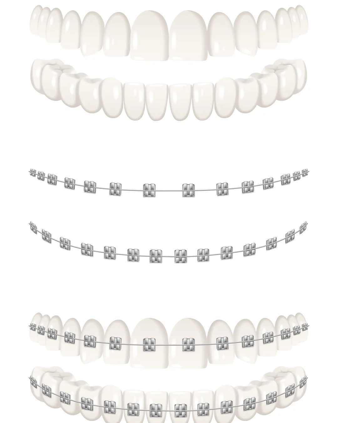 Orthodontics