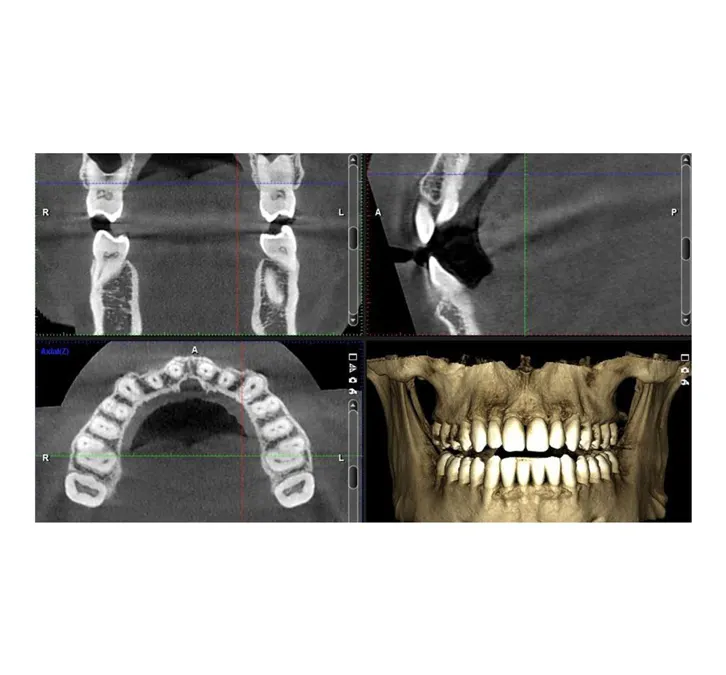 Cosmetic dentistry